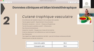 IFMK-JLP2021- Instabilité rotulienne - C.Houdemon