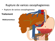 5.3 Hémorragies digestives (pour comprendre).mp4