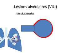 1-5 Ventilation mécanique (indispensables).mp4