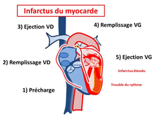 8-2 Principales Causes ACR (indispensables).mp4